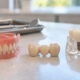 Dentures vs. Dental Bridges vs Dental Implants