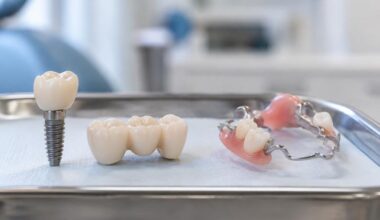 How to Compare Tooth Replacement Choices by Upfront Price Long Term Care and Daily Comfort in Cliffside Park NJ