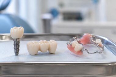 How to Compare Tooth Replacement Choices by Upfront Price Long Term Care and Daily Comfort in Cliffside Park NJ